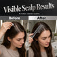 💆 50 % RABATT NU! 💖 Hårbottensapplikator kamverktyg – precisionskam, jämn fördelning & skonsam rullkontakt – perfekt för daglig hårbottenvård ✨